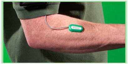 Surface Emg
